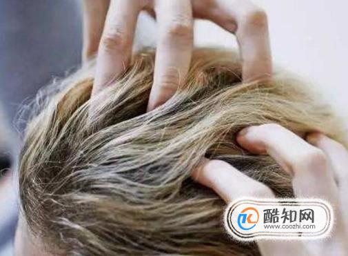 Ԥ��ͷ����׵���Ч��������Щ������